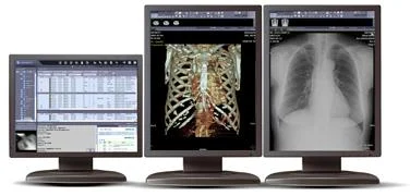 Metodologías ágiles para la analítica